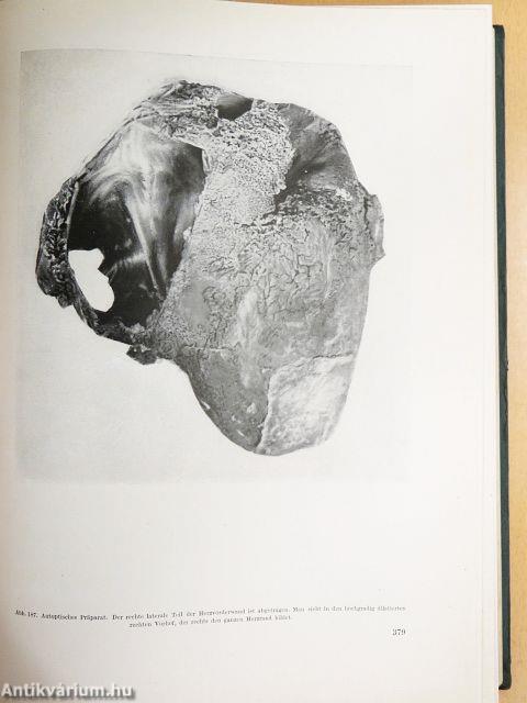 Vergleichende Herzdiagnostik