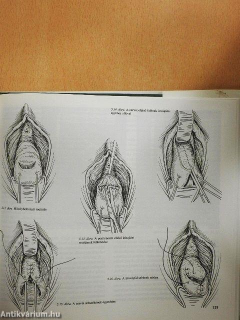 Szülészeti-nőgyógyászati műtéttan 1-2.