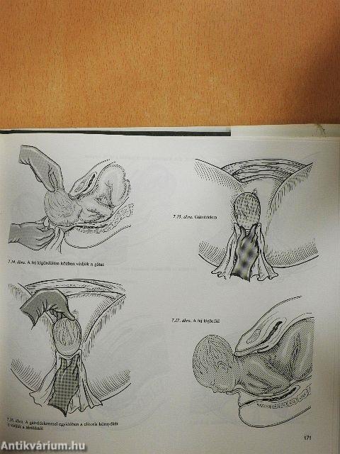 Szülészeti-nőgyógyászati műtéttan 1-2.