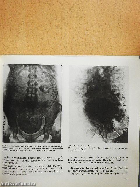 Szülészet-nőgyógyászat 1-3.