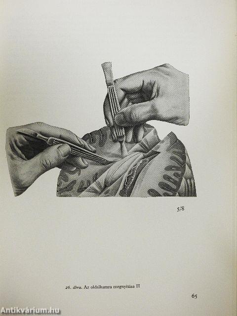 Az agyvelő boncolása