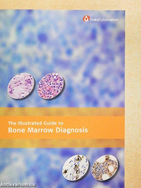 The Illustrated Guide to Bone Marrow Diagnosis