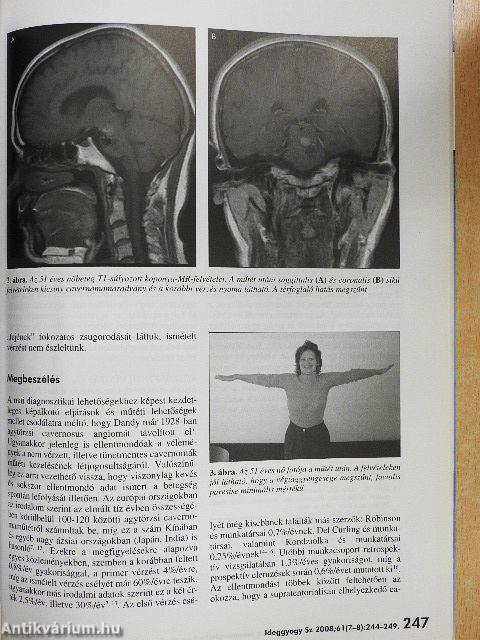 Ideggyógyászati Szemle 2008. július 30.