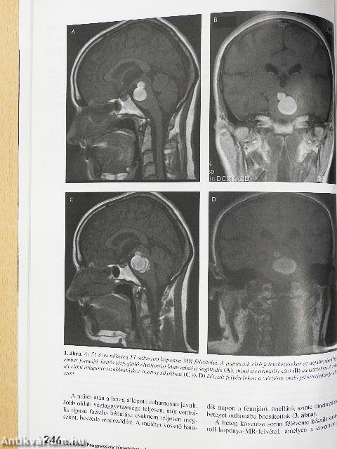 Ideggyógyászati Szemle 2008. július 30.