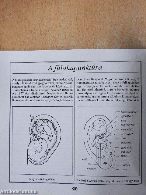 Fogyjunk akupunktúrával és diétával!