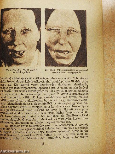 Küzdelem a rák ellen