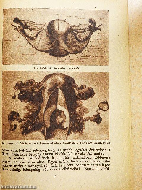 Küzdelem a rák ellen