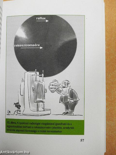 Refluxbetegség - gyomorsav okozta bántalmak