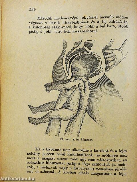 Magyar bábakönyv a bábai hivatás gyakorlásáról (rossz állapotú)