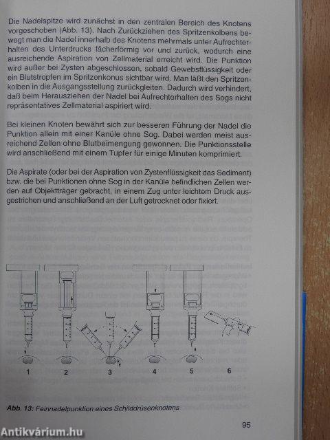Schilddrüsenkrankheiten
