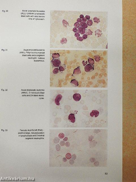 Hematological Laboratory Methods