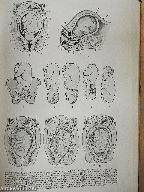 Der Gesundheits Brockhaus