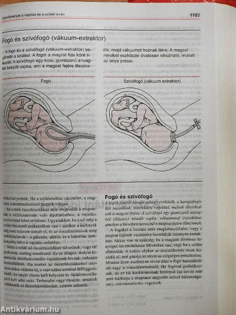 MSD Orvosi Kézikönyv a Családban