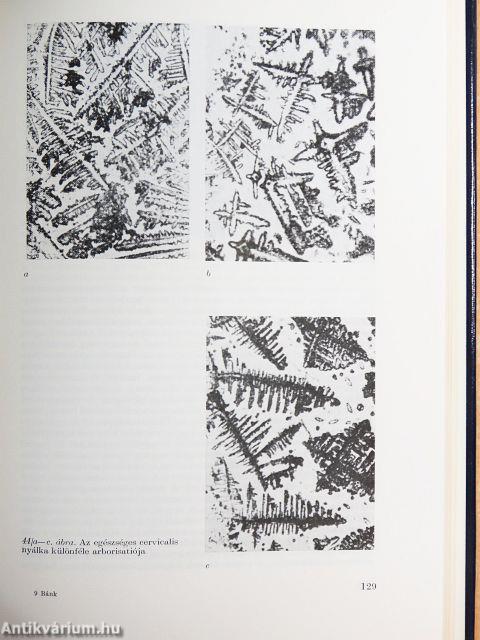 Homolog művi inseminatio a meddő házasságban