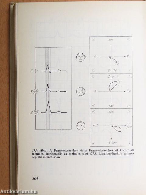 Electrocardiologia az orvosi gyakorlatban