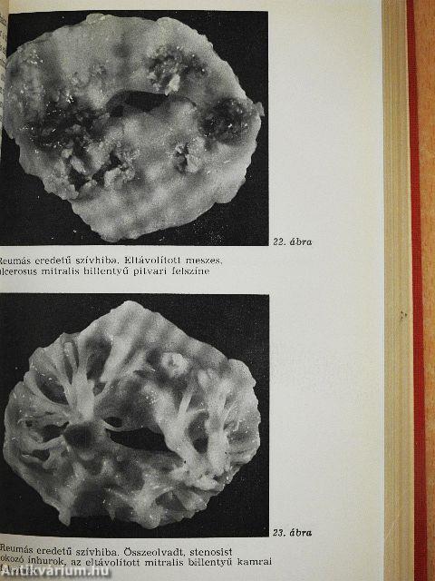 Szív- és érrendszeri betegségek