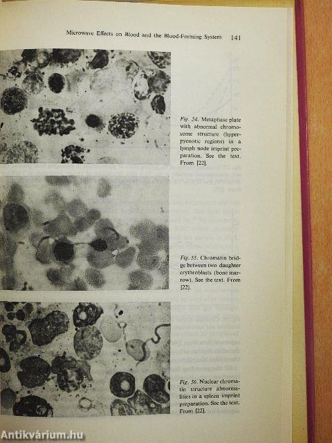 Biological Effects of Microwaves