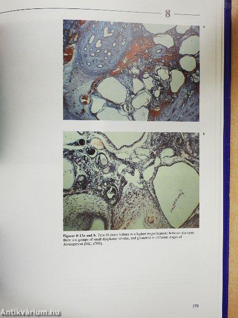 Atlas of Fetal Diagnosis