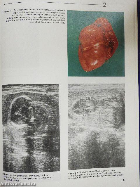 Atlas of Fetal Diagnosis