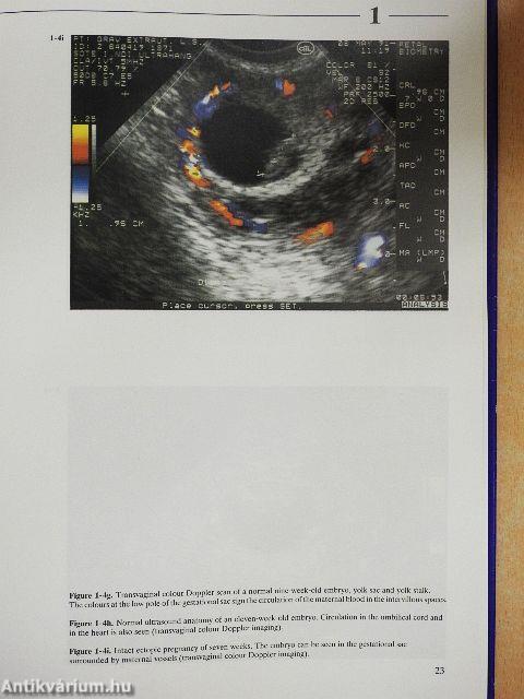 Atlas of Fetal Diagnosis