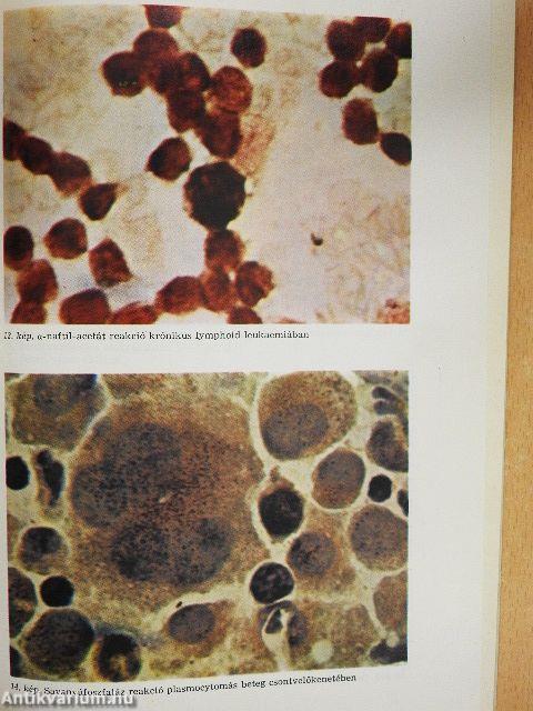 Haematologiai laboratóriumi vizsgálómódszerek