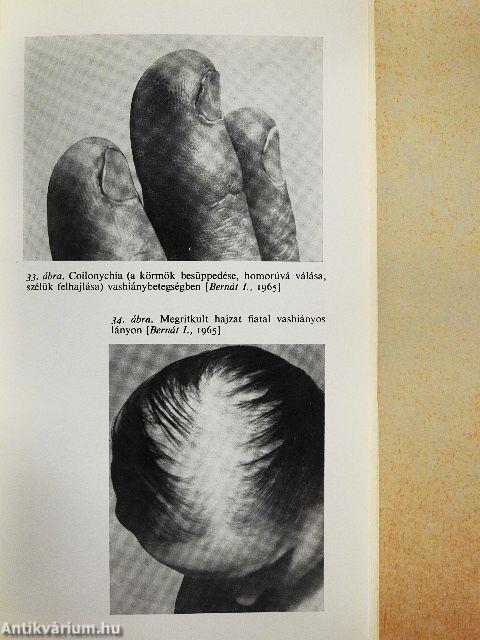 A vasanyagcseréről röviden