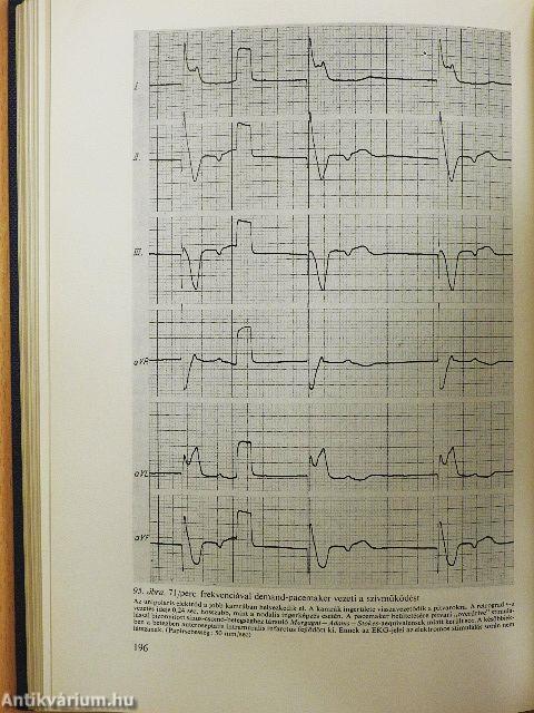 Intenzív betegellátás
