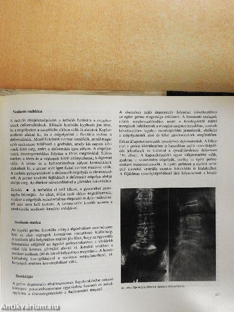 Az ortopédia tankönyve