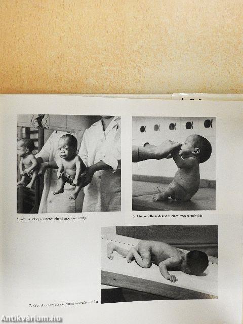 Fejlődésneurológia, neurohabilitáció