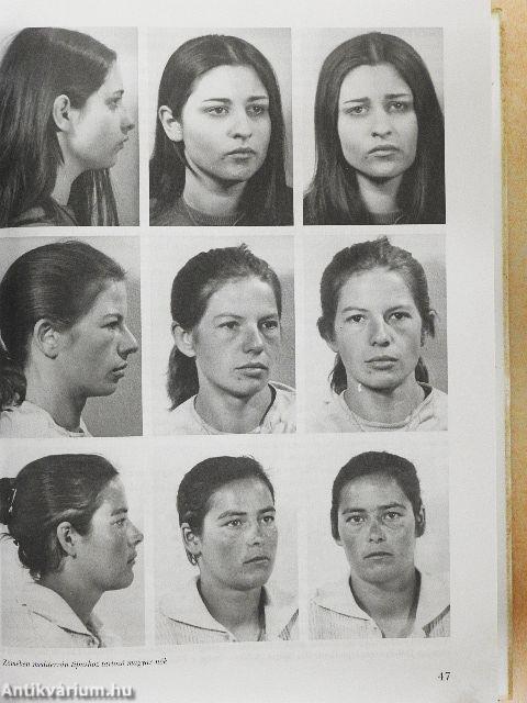 A magyarság embertana