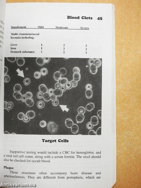 Silent Clots