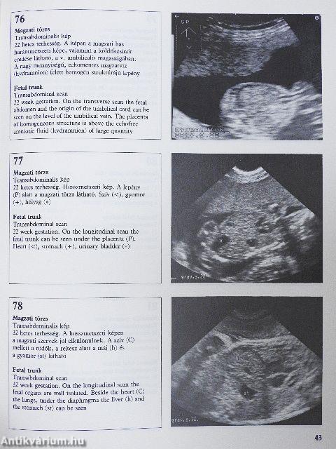 Szülészeti-nőgyógyászati ultrahang-diagnosztika Atlasz