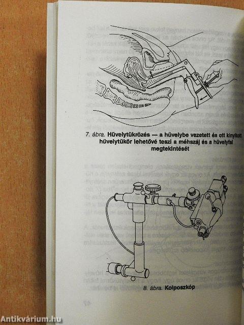 A női daganatok megelőzhetők