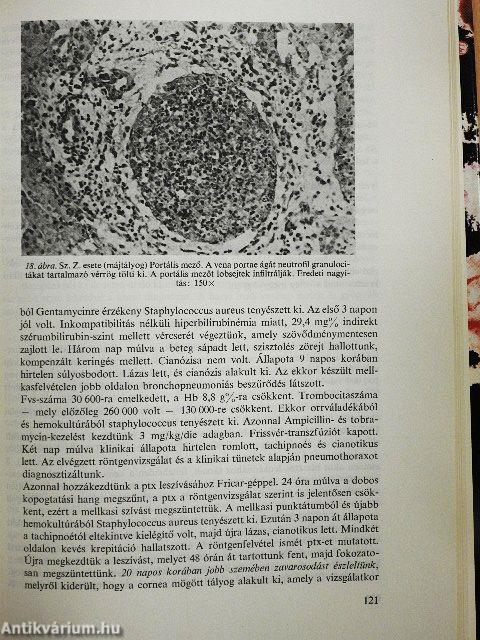 Újszülöttkori fertőzések