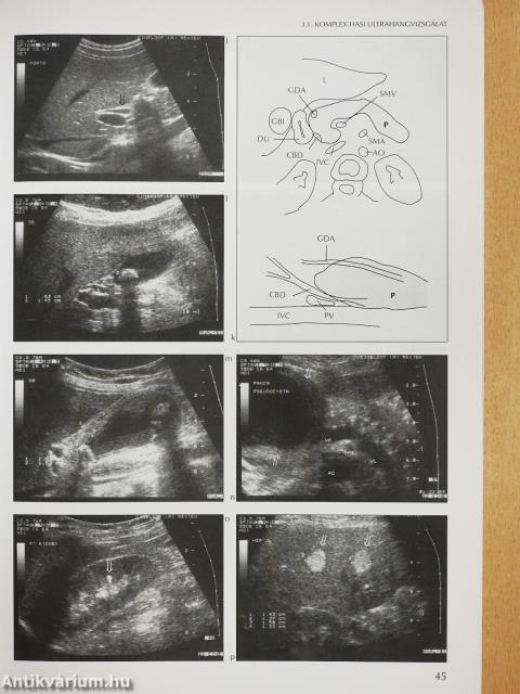Hogyan vizsgáljunk ultrahanggal? (dedikált példány)