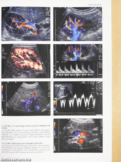 Hogyan vizsgáljunk ultrahanggal? (dedikált példány)
