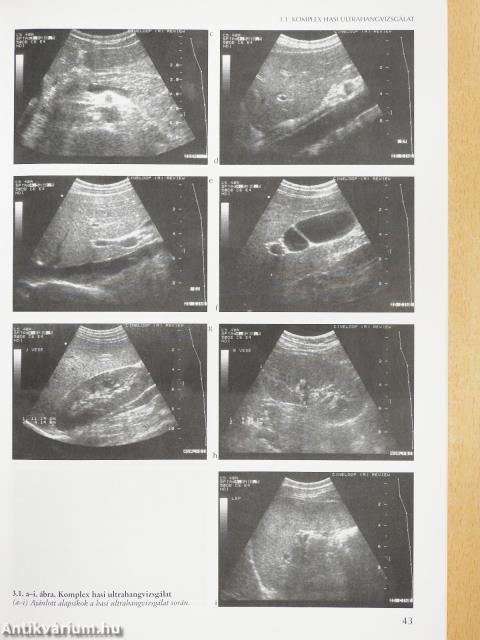 Hogyan vizsgáljunk ultrahanggal? (dedikált példány)