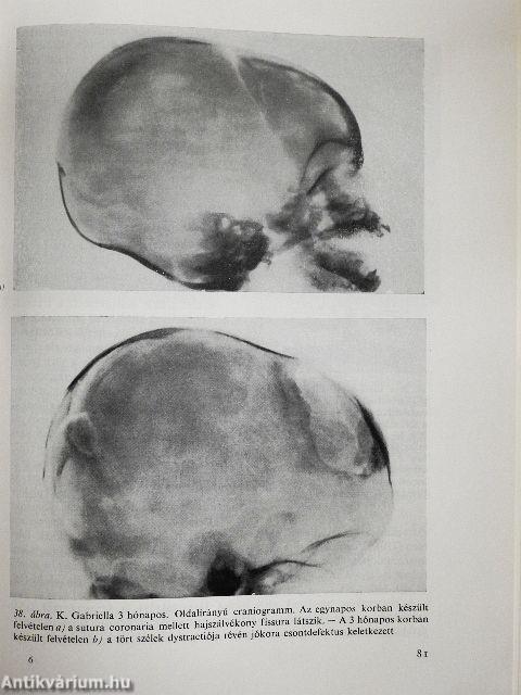 Ideggyógyászati és idegsebészeti vizsgálatok csecsemő- és gyermekkorban