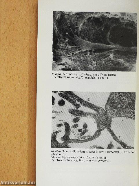 A daganatok áttétképzése