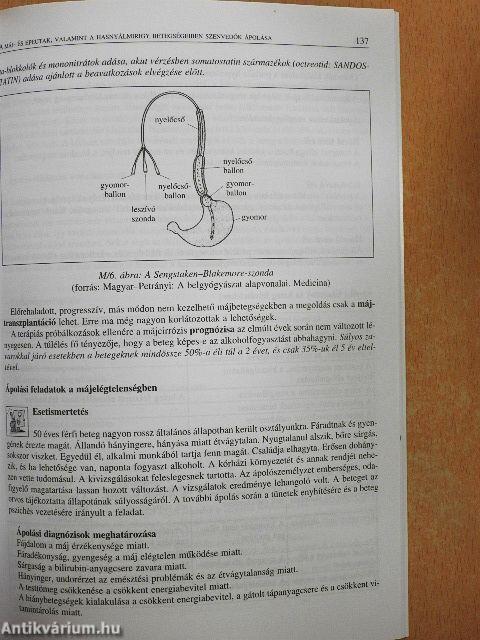 Az emésztőszervi betegségekben szenvedő betegek ápolása