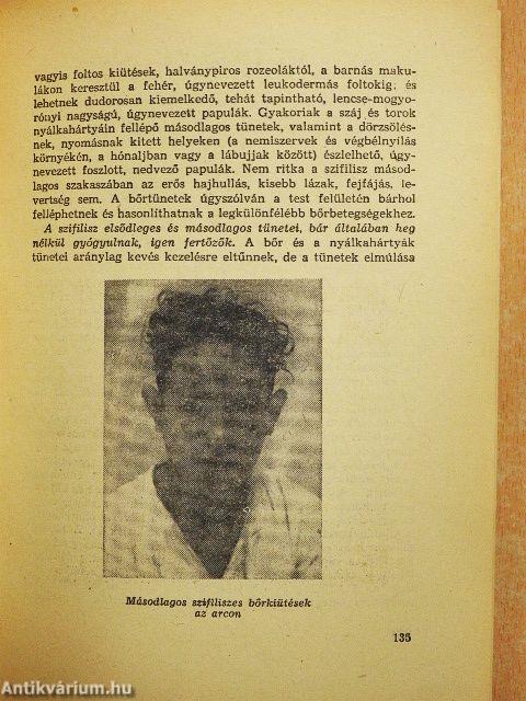 A nemi élet kérdései