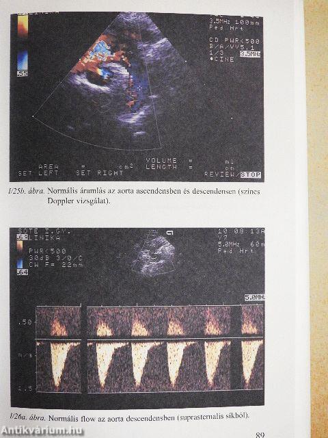 Gyermekkardiológia a gyakorlatban