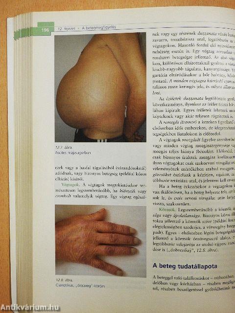 Általános ápolástan és gondozástan