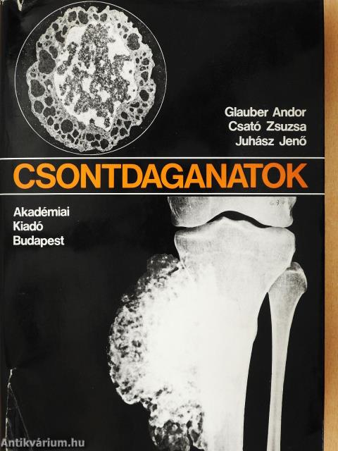 Csontdaganatok (kétszeresen dedikált példány)