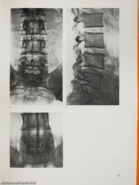 Csontdaganatok (kétszeresen dedikált példány)
