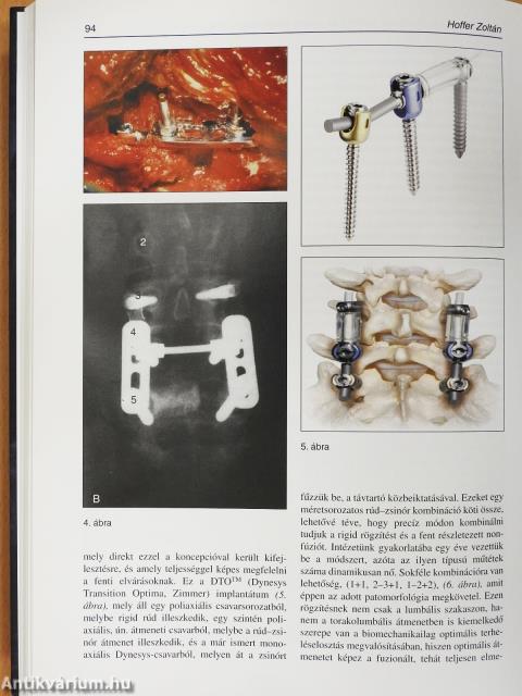 Modern gerincgyógyászat (dedikált példány)