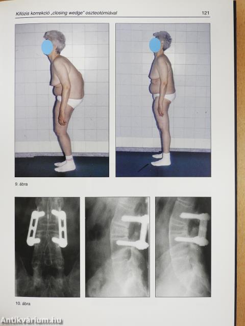 Modern gerincgyógyászat (dedikált példány)