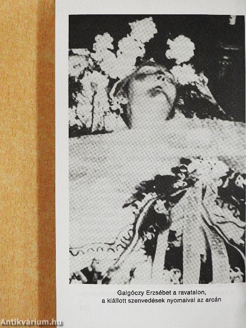 A szeretet nem ismer határt