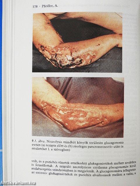 Téves diagnózisok a belgyógyászatban