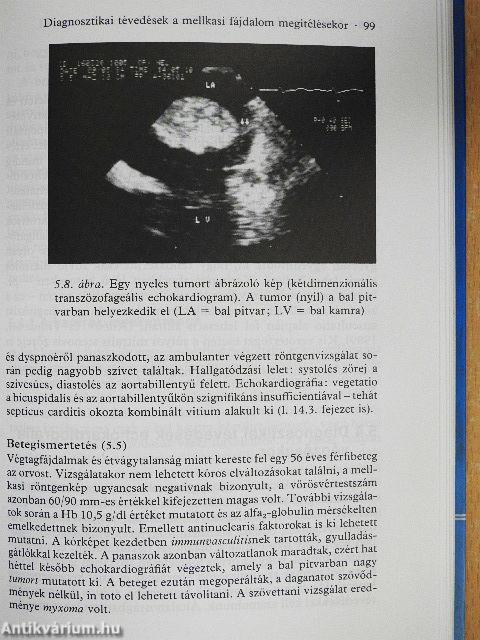 Téves diagnózisok a belgyógyászatban